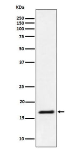Anti-Ube2L3 / UBCH7 Rabbit Monoclonal Antibody Boster Bio