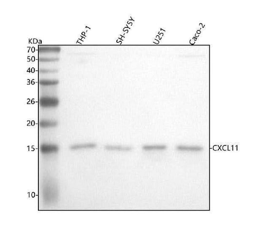 Anti-CXCL11 Rabbit Monoclonal Antibody Boster Bio