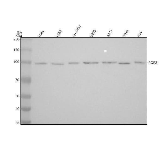 Anti-ROR2 Rabbit Monoclonal Antibody Boster Bio