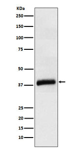 Anti-APOL1 Rabbit Monoclonal Antibody Boster Bio
