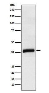 Anti-APOL1 Rabbit Monoclonal Antibody Boster Bio