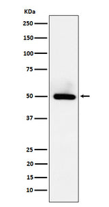Anti-BMP15 Rabbit Monoclonal Antibody Boster Bio