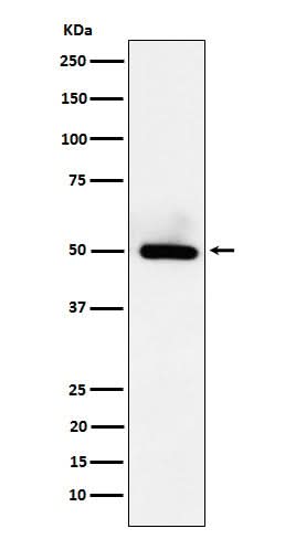 Anti-BMP15 Rabbit Monoclonal Antibody Boster Bio