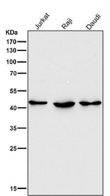 Anti-HDAC8/Histone Deacetylase 8 Rabbit Monoclonal Antibody Boster Bio