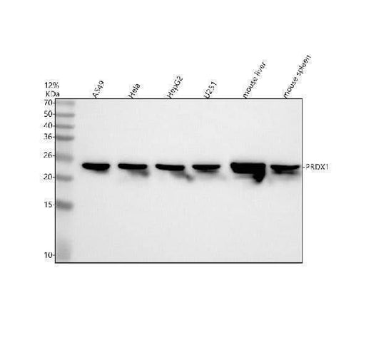 Anti-PRDX1/Peroxiredoxin 1 Rabbit Monoclonal Antibody Boster Bio