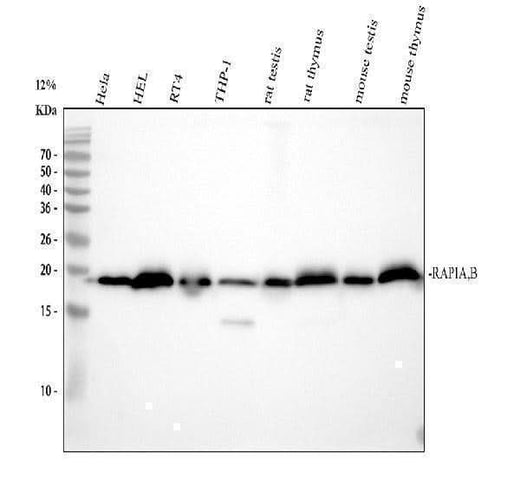 Anti-RAP1A + RAP1B Rabbit Monoclonal Antibody Boster Bio