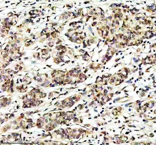Anti-JAB1 Monoclonal Antibody Boster Bio