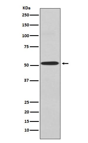 Anti-Kir2.1 Rabbit Monoclonal Antibody Boster Bio