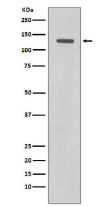 Anti-Rad21 Rabbit Monoclonal Antibody Boster Bio