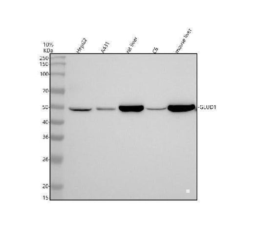 Anti-GLUD1 Rabbit Monoclonal Antibody Boster Bio
