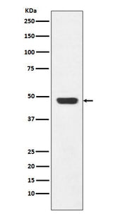 Anti-GAP43 Rabbit Monoclonal Antibody Boster Bio