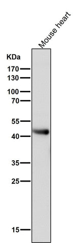 Anti-ADIPOR1 Rabbit Monoclonal Antibody Boster Bio