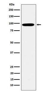 Anti-Epsin 1 Rabbit Monoclonal Antibody Boster Bio
