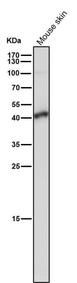 Anti-TMEM173 Monoclonal Antibody Boster Bio