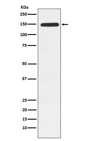 Anti-Xanthine Oxidase Rabbit Monoclonal Antibody Boster Bio