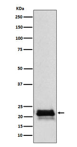 Anti-FSH beta (FSHB) Monoclonal Antibody Boster Bio