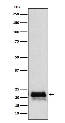 Anti-FSH beta (FSHB) Monoclonal Antibody Boster Bio