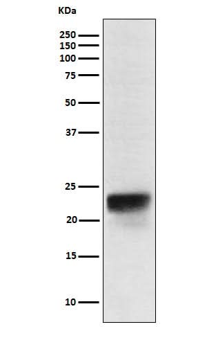 Anti-FSH beta Rabbit Monoclonal Antibody Boster Bio