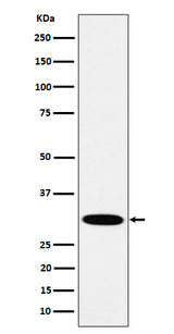 Anti-HMGCL Rabbit Monoclonal Antibody Boster Bio