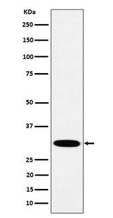 Anti-HMGCL Rabbit Monoclonal Antibody Boster Bio