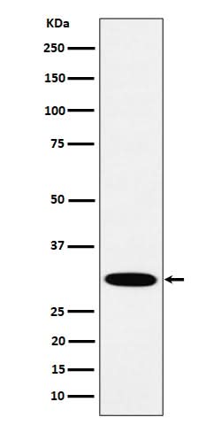 Anti-HMGCL Rabbit Monoclonal Antibody Boster Bio