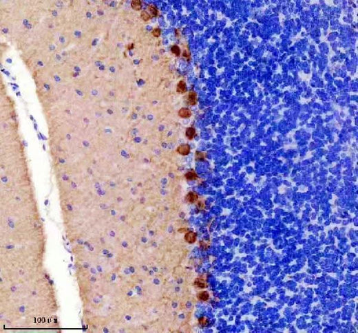 Anti-PKC gamma Rabbit Monoclonal Antibody Boster Bio
