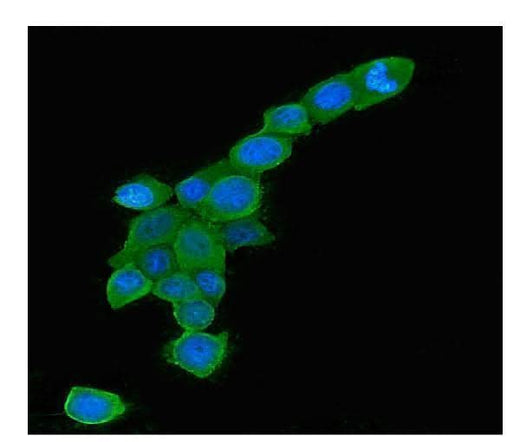 Anti-Rab5/RAB5A Antibody Picoband® (monoclonal, 3E9 Boster Bio
