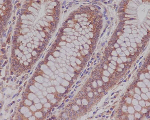 Anti-Rab5 RAB5A Rabbit Monoclonal Antibody Boster Bio