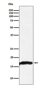 Anti-CRYAA Rabbit Monoclonal Antibody Boster Bio