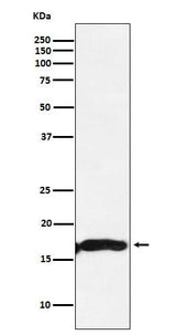 Anti-CRYAA Rabbit Monoclonal Antibody Boster Bio
