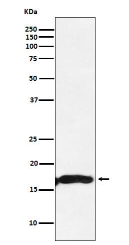 Anti-CRYAA Rabbit Monoclonal Antibody Boster Bio