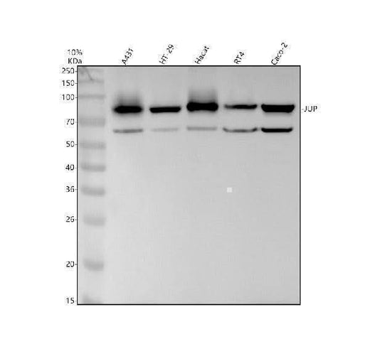 Anti-Catenin gamma JUP Rabbit Monoclonal Antibody Boster Bio