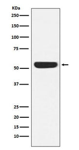 Anti-CAMKIV Rabbit Monoclonal Antibody Boster Bio