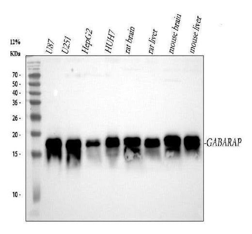 Anti-GABARAP Monoclonal Antibody Boster Bio