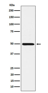 Anti-HGD Rabbit Monoclonal Antibody Boster Bio