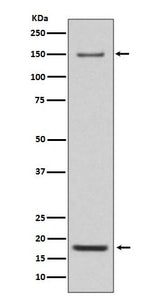 Anti-Integrin alpha 5 ITGA5 Rabbit Monoclonal Antibody Boster Bio