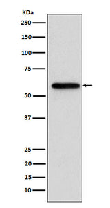 Anti-Retinoic Acid Receptor beta RARB Monoclonal Antibody Boster Bio