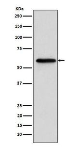 Anti-Retinoic Acid Receptor beta RARB Monoclonal Antibody Boster Bio