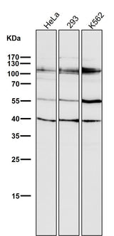 Anti-HDAC7/Histone Deacetylase 7 Rabbit Monoclonal Antibody Boster Bio