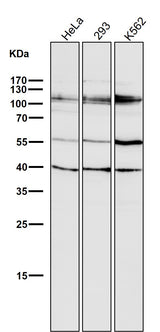 Anti-HDAC7/Histone Deacetylase 7 Rabbit Monoclonal Antibody Boster Bio