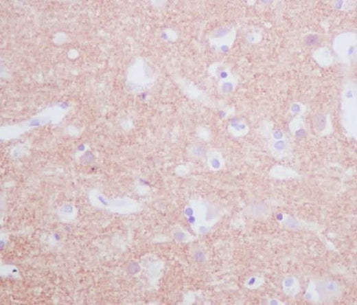 Anti-Tyrosine Hydroxylase TH Rabbit Monoclonal Antibody Boster Bio