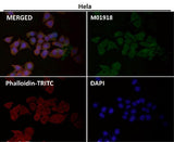 Anti-IKK alpha+beta CHUK Rabbit Monoclonal Antibody Boster Bio