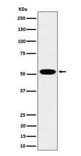 Anti-LAP3 Rabbit Monoclonal Antibody Boster Bio