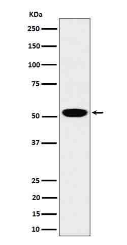 Anti-LAP3 Rabbit Monoclonal Antibody Boster Bio