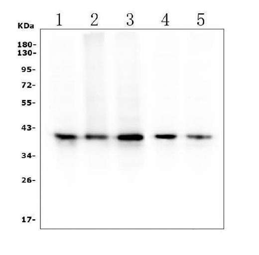 Anti-RP2 Antibody Picoband® (monoclonal, 3D7 Boster Bio