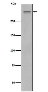 Anti-Plectin Rabbit Monoclonal Antibody Boster Bio