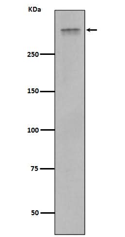 Anti-Plectin Rabbit Monoclonal Antibody Boster Bio