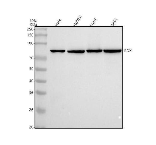 Anti-Radixin Rabbit Monoclonal Antibody Boster Bio