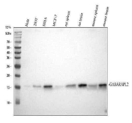 Anti-GABARAPL2 Rabbit Monoclonal Antibody Boster Bio