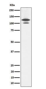 Anti-RASA1 Rabbit Monoclonal Antibody Boster Bio